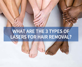 What are the 3 types of lasers for hair removal?
