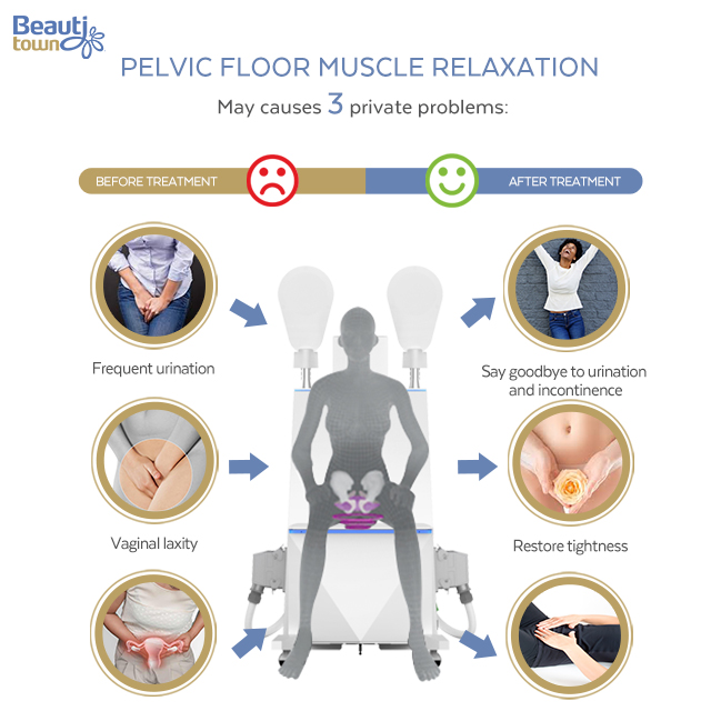 pelvic floor muscle hiemt high intensity electromagnetic tech
